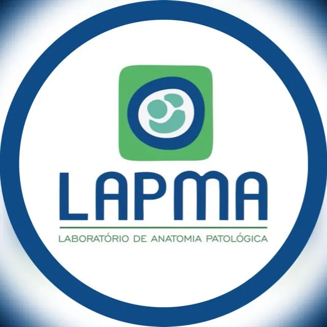 Lapma